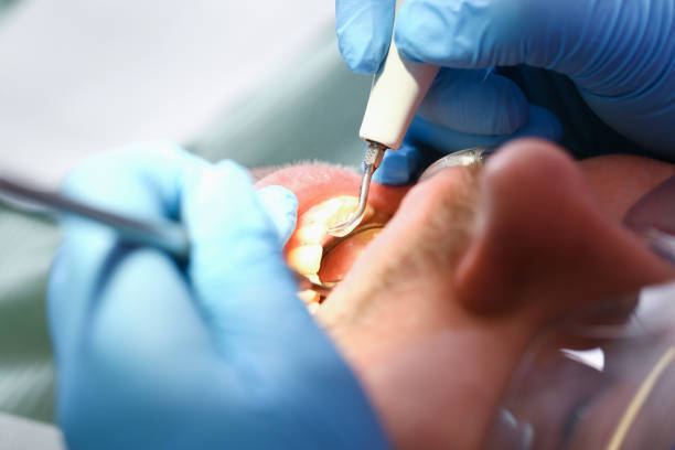 Best Emergency Treatment for Dental Infections or Abscesses in Minturn, CO